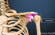 الكتف فيلم التدريب المشترك Acromyoclavicular 