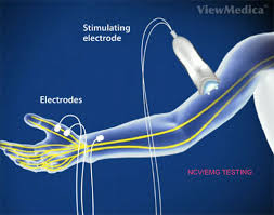 Electrodiagnostic test