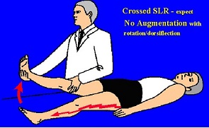 SLR, تست لازک , تست ستون فقرات